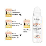 Conveniently Apply Roller Hair In-growth For Men
