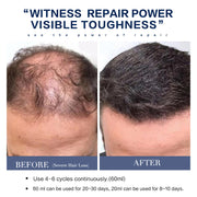 Hair Care Solution For Rapid Growth With Seborrheic Properties